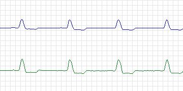 n13c thumbnail