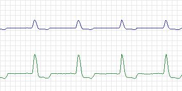 n14c thumbnail