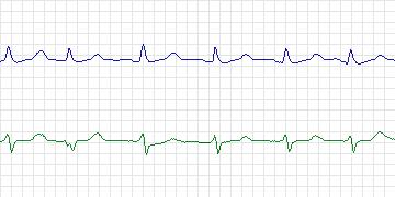 n15c thumbnail