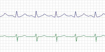 n16c thumbnail