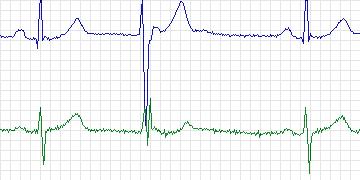 n45c thumbnail