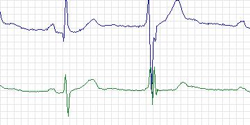 n46c thumbnail