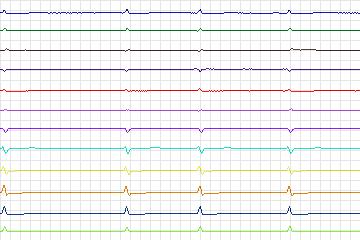 s0080lre-patient023 thumbnail