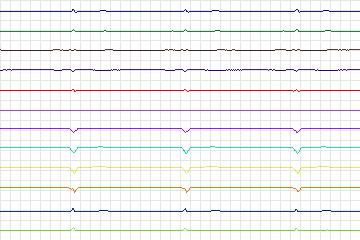 s0083lre-patient024 thumbnail