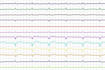 s0109lre-patient034 thumbnail