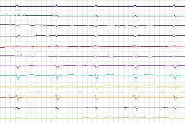s0124lre-patient035 thumbnail