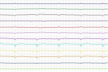 s0132lre-patient041 thumbnail