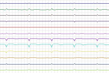 s0135lre-patient042 thumbnail