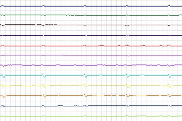 s0145lre-patient035 thumbnail