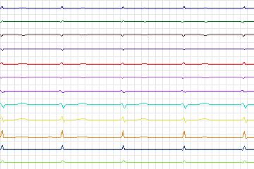 s0148lre-patient045 thumbnail
