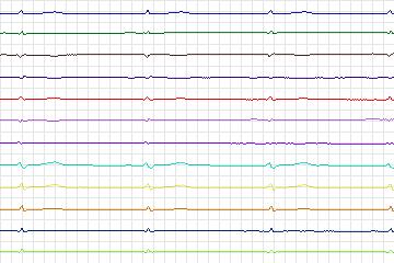 s0149lre-patient022 thumbnail