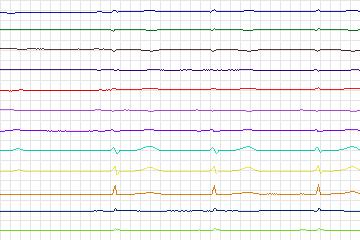 s0155lre-patient045 thumbnail