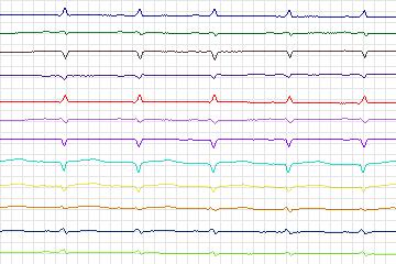 s0156lre-patient046 thumbnail