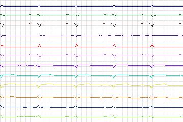 s0161lre-patient046 thumbnail