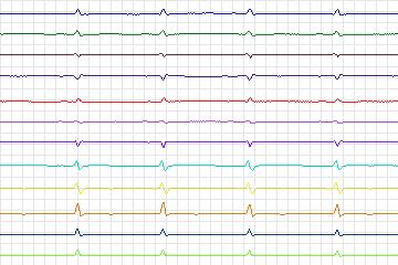 s0179lre-patient051 thumbnail