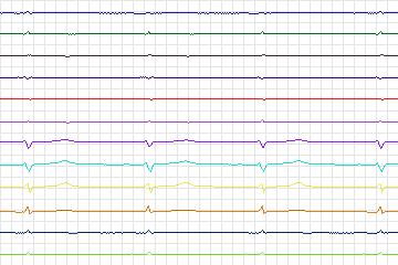 s0186lre-patient049 thumbnail
