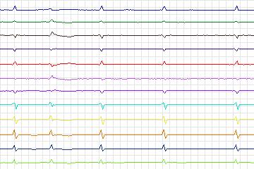 s0193_re-patient162 thumbnail