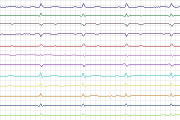 s0195lre-patient054 thumbnail