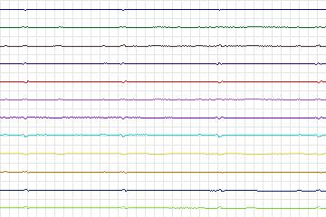s0196lre-patient056 thumbnail