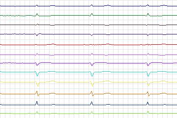 s0215lre-patient050 thumbnail