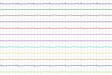 s0227lre-patient067 thumbnail
