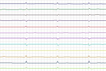 s0231lre-patient066 thumbnail