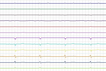 s0237lre-patient072 thumbnail