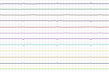 s0238lre-patient073 thumbnail