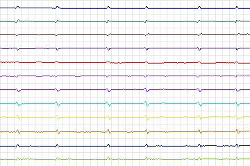 s0239lre-patient074 thumbnail