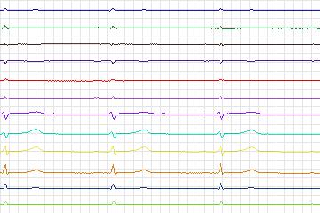 s0240lre-patient072 thumbnail
