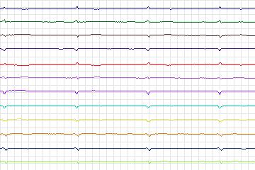 s0243lre-patient073 thumbnail