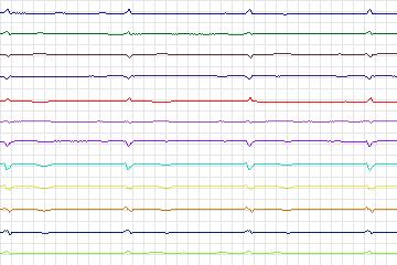 s0249lre-patient073 thumbnail