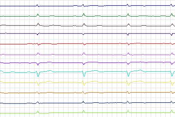 s0268lre-patient083 thumbnail
