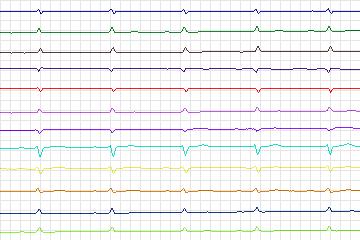 s0272lre-patient083 thumbnail