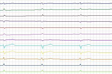 s0286lre-patient083 thumbnail