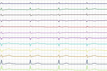 s0293lre-patient186 thumbnail