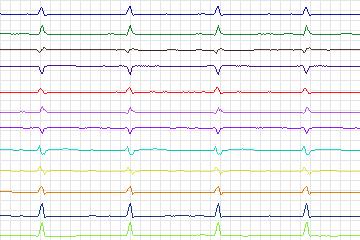 s0337lre-patient195 thumbnail