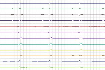s0350lre-patient197 thumbnail