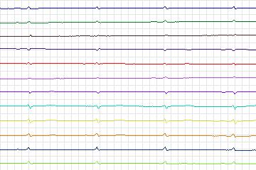 s0358lre-patient092 thumbnail