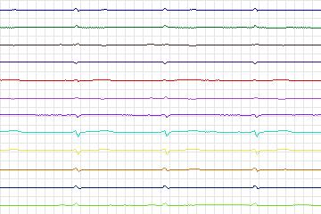 s0362lre-patient092 thumbnail