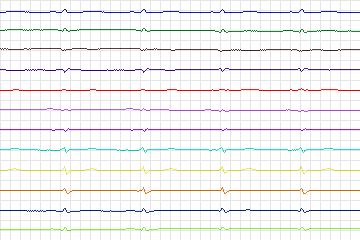 s0367lre-patient093 thumbnail
