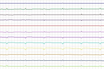 s0368lre-patient094 thumbnail