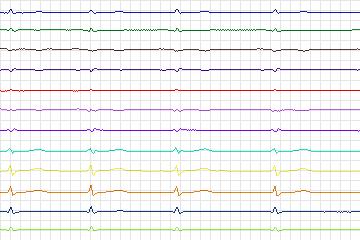 s0371lre-patient093 thumbnail