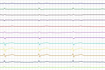 s0373lre-patient095 thumbnail
