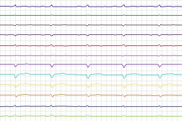 s0379lre-patient096 thumbnail