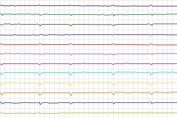 s0380lre-patient097 thumbnail
