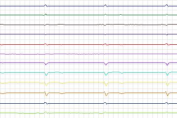 s0395lre-patient096 thumbnail