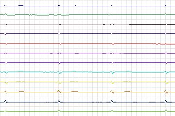 s0411lre-patient092 thumbnail